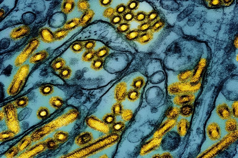 US identifies 65-year-old in Louisiana as first severe case of bird flu